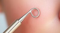 top blackhead removal tools