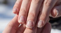 cold weather causes nail splitting