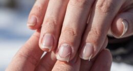cold weather causes nail splitting