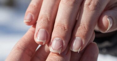 cold weather causes nail splitting