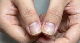 damaging cuticle grooming habits