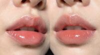 differences in lip shine