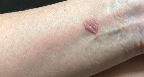 different scar treatments needed