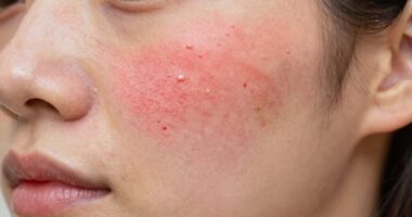 identify makeup reaction quickly