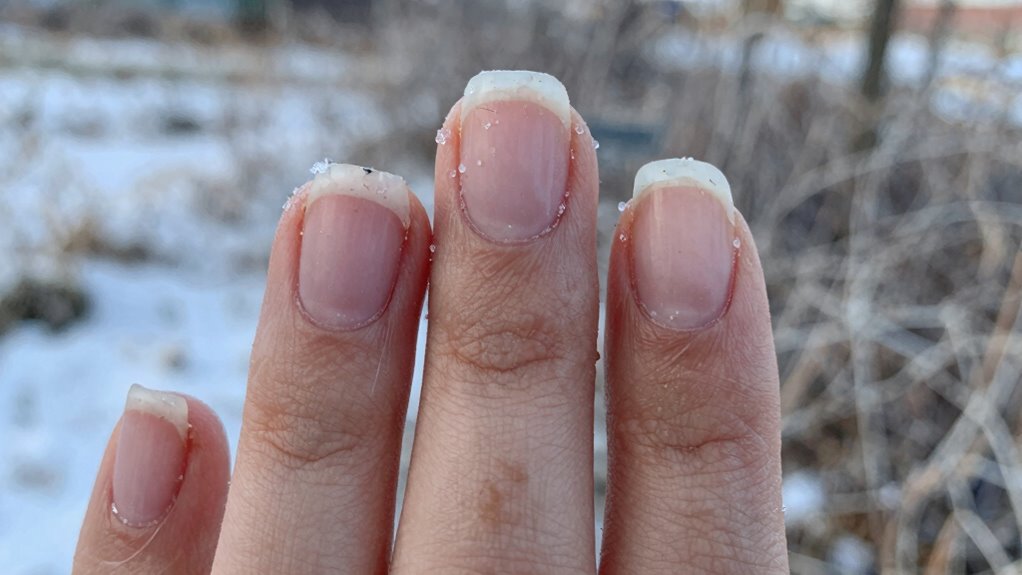 protect nails from environment