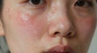 signs of skin damage