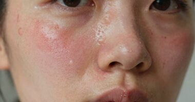 signs of skin damage