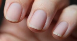 matte nails reveal flaws