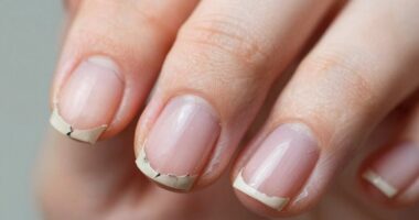 nail peeling despite caution
