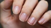 nail recovery after polish