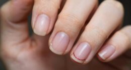 nail recovery after polish