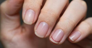 nail recovery after polish