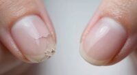 nail strength and texture