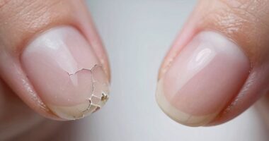 nail strength and texture