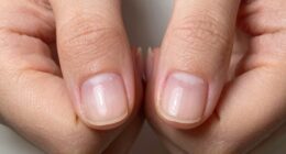 nail strength versus hardness