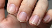 neglecting cuticle care habits