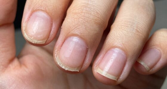 neglecting cuticle care habits