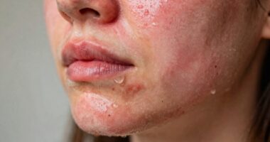 signs of harsh cleanser