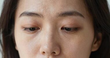 unrested skin appearance fix