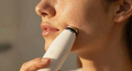 10 Best Ultrasonic Skin Scrubber For Blackheads In 2026