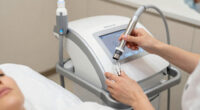 13 Best Top Rated Diamond Microdermabrasion Machine For Acne Scars In 2026